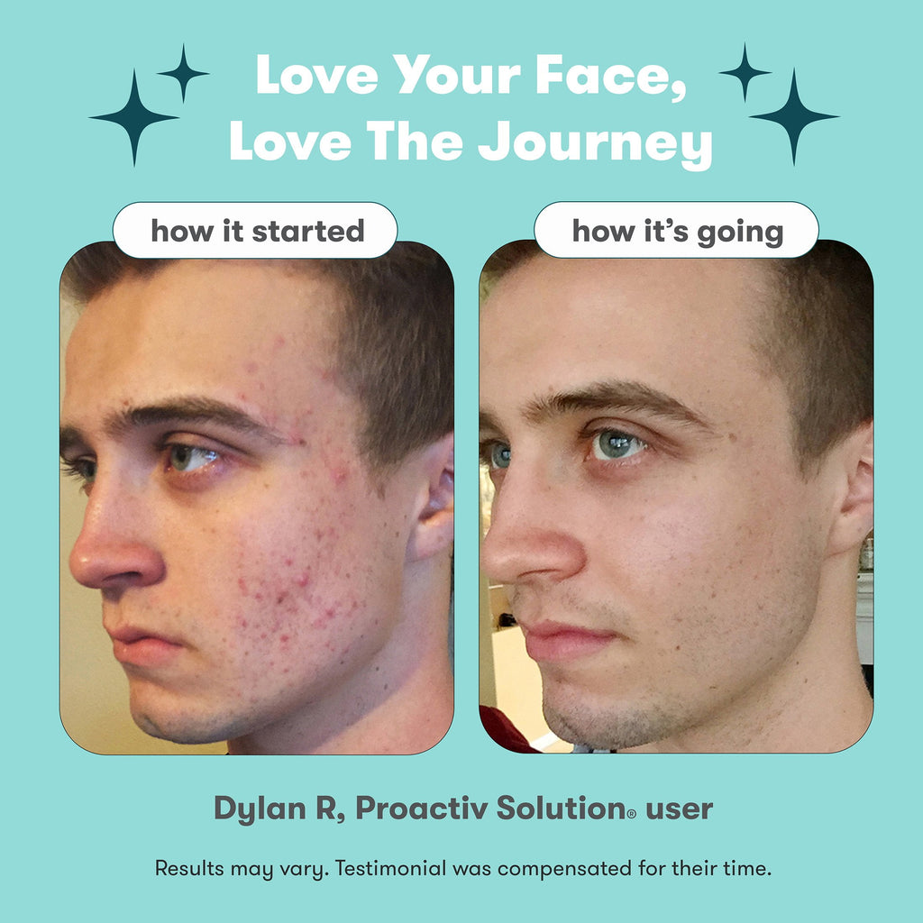 Proactiv Solution 3-Step Mini Acne Treatment System for Oily and Combination Skin